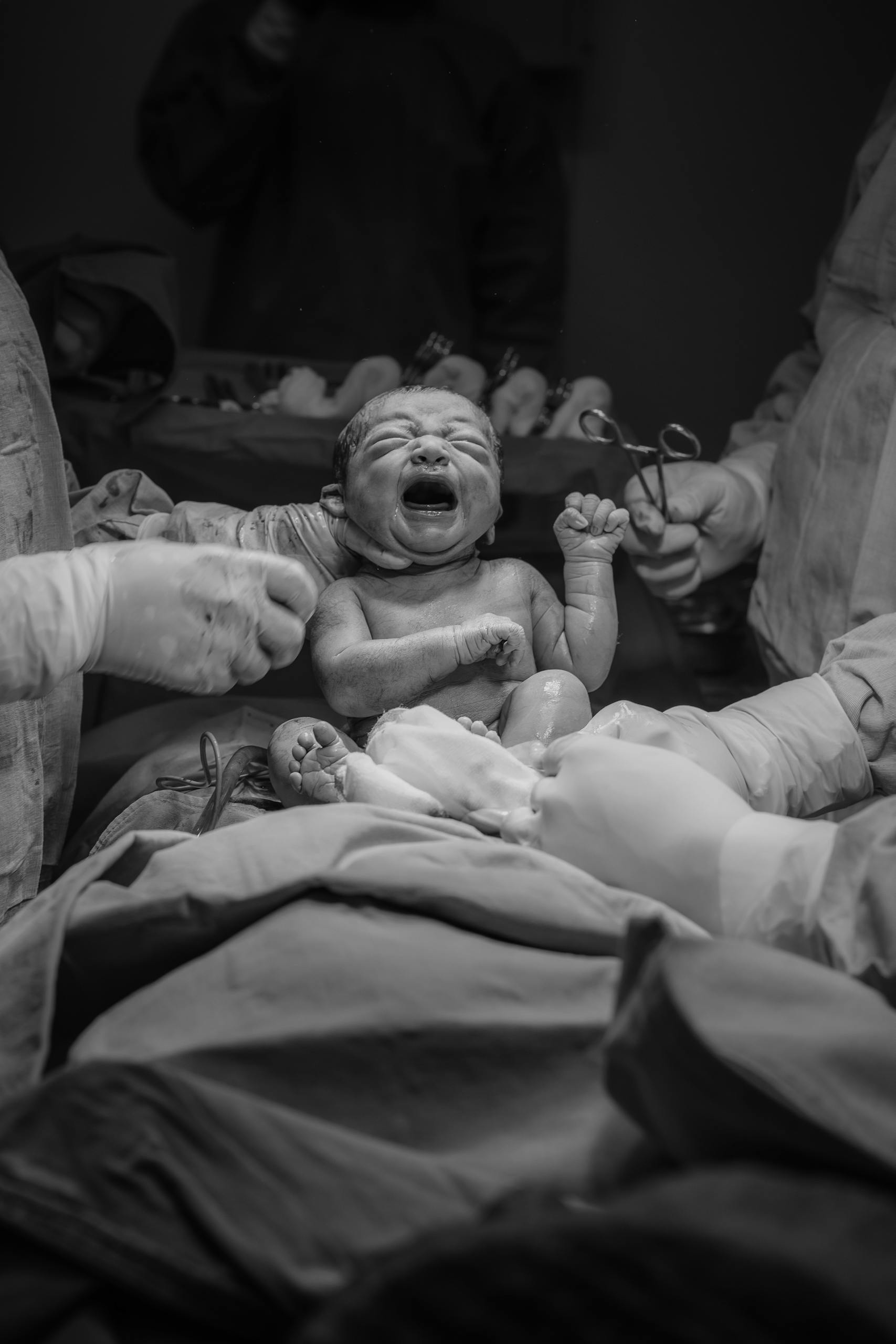 Black and white photo of a newborn baby delivered in a hospital operating room.